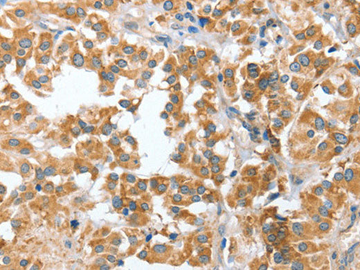 CIAPIN1 Polyclonal Antibody Store at -20°C