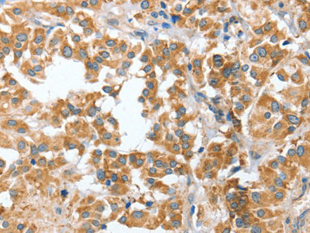 CIAPIN1 Polyclonal Antibody Store at -20°C