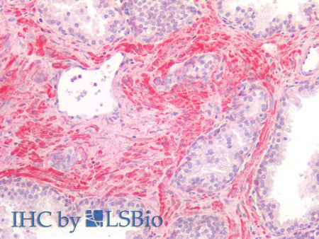 BMP4 Polyclonal Antibody Store at -20°C