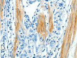 CAV3 Polyclonal Antibody Store at -20°C