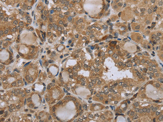 STMN2/3/4 Polyclonal Antibody Store at -20°C