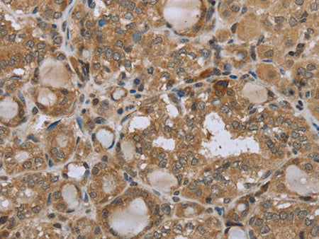 STMN2/3/4 Polyclonal Antibody Store at -20°C