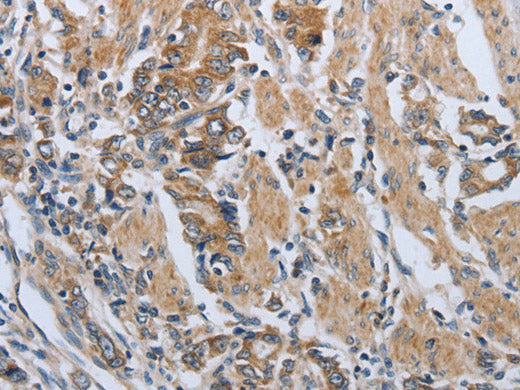 PD-1/CD279 Polyclonal Antibody Store at -20°C