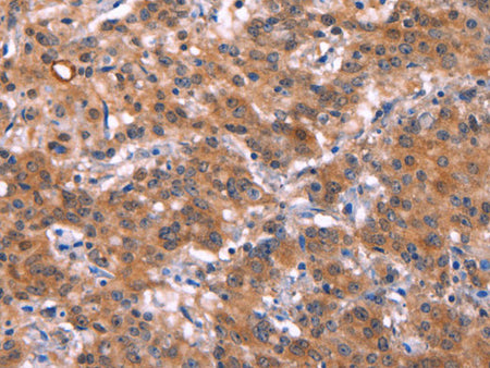 HMGCS1 Polyclonal Antibody Store at -20°C
