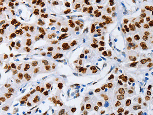 MUTYH Polyclonal Antibody Store at -20°C