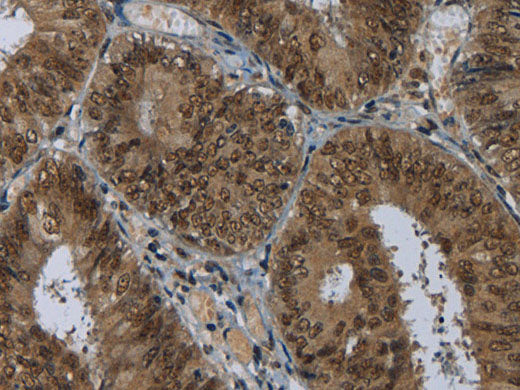 MRE11 Polyclonal Antibody Store at -20°C