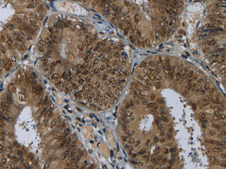 MRE11 Polyclonal Antibody Store at -20°C