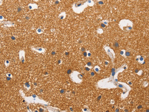 HK2 Polyclonal Antibody Store at -20°C