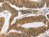 PIK3R3 Polyclonal Antibody Store at -20°C