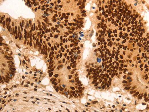 E2F7 Polyclonal Antibody