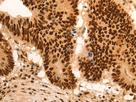 E2F7 Polyclonal Antibody