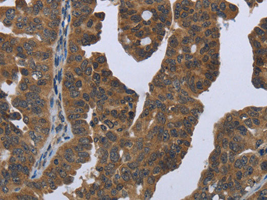 GYS2 Polyclonal Antibody Store at -20°C