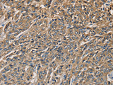 KLK1 Polyclonal Antibody Store at -20°C