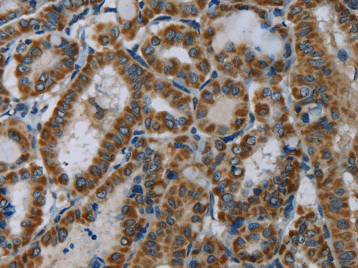 NDUFA5 Polyclonal Antibody Store at -20°C