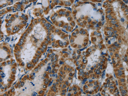 NDUFA5 Polyclonal Antibody Store at -20°C