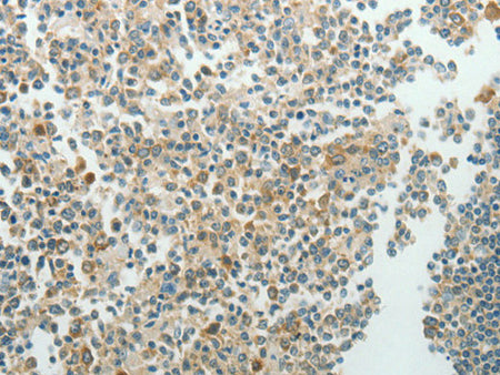 NDRG3 Polyclonal Antibody Store at -20°C