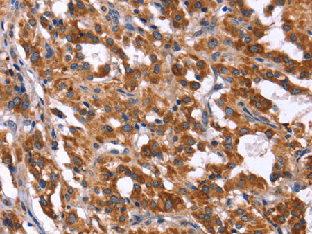 HACE1 Polyclonal Antibody Store at -20°C
