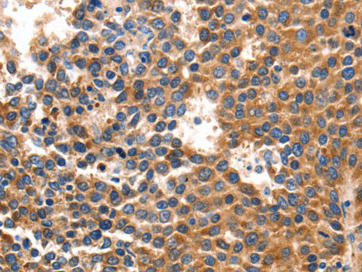 IRF1 Polyclonal Antibody Store at -20°C