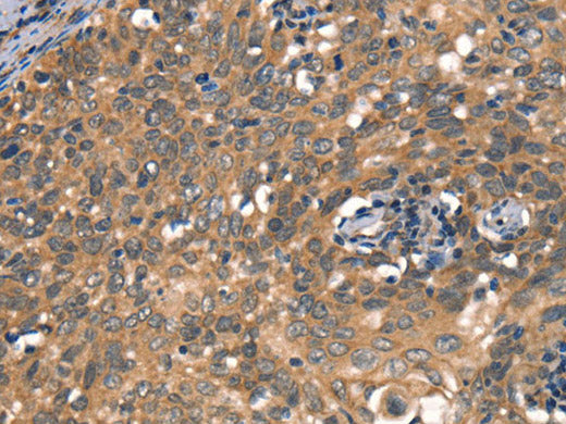 DAAM1 Polyclonal Antibody Store at -20°C