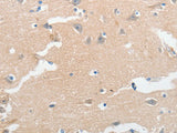 LCN2 Polyclonal Antibody Store at -20°C