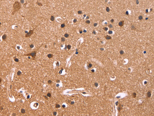 CSNK1D Polyclonal Antibody Store at -20°C