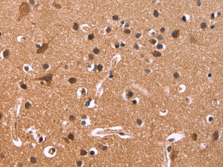 CSNK1D Polyclonal Antibody Store at -20°C