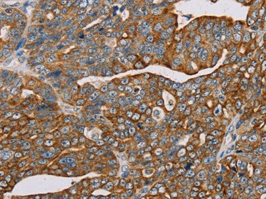 MTFP1 Polyclonal Antibody Store at -20°C