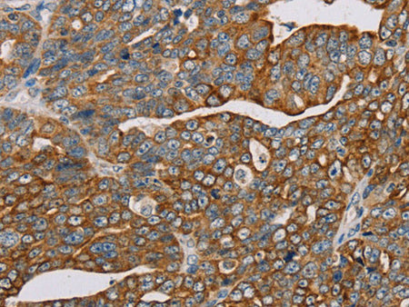 MTFP1 Polyclonal Antibody Store at -20°C