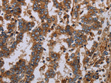 GDF2 Polyclonal Antibody Store at -20°C