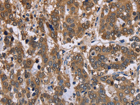 FBP2 Polyclonal Antibody Store at -20°C