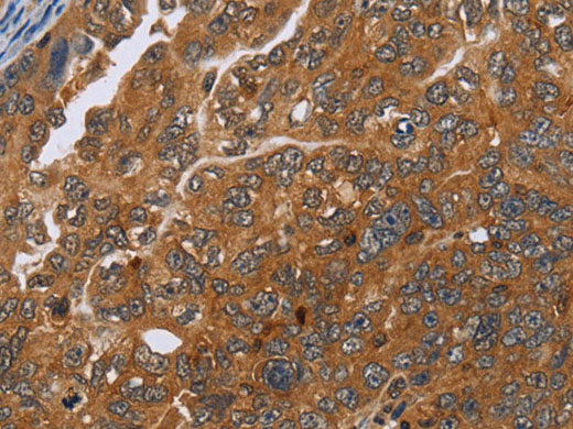 ADAMTS15 Polyclonal Antibody Store at -20°C
