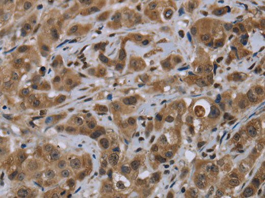 FTO Polyclonal Antibody Store at -20°C