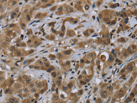 FTO Polyclonal Antibody Store at -20°C