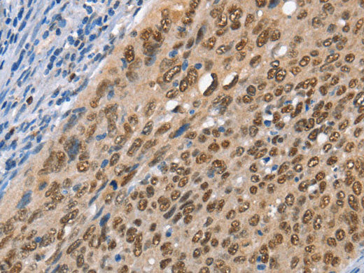 MCM6 Polyclonal Antibody Store at -20°C