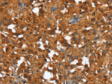 CTBP1 Polyclonal Antibody Store at -20°C