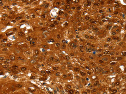 NCOR1 Polyclonal Antibody Store at -20°C
