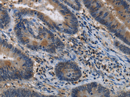ITPR2 Polyclonal Antibody Store at -20°C
