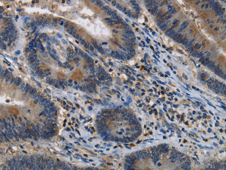 ITPR2 Polyclonal Antibody Store at -20°C