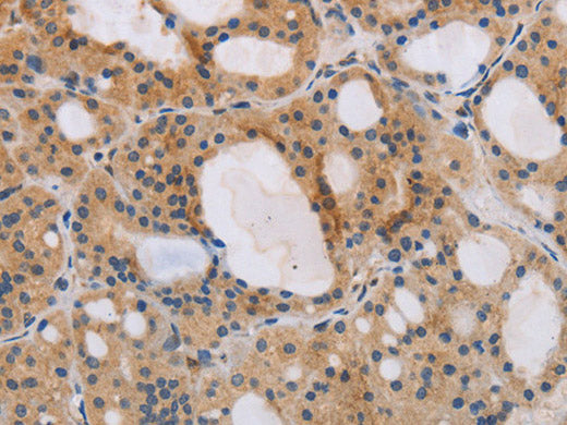 ITPR1 Polyclonal Antibody Store at -20°C