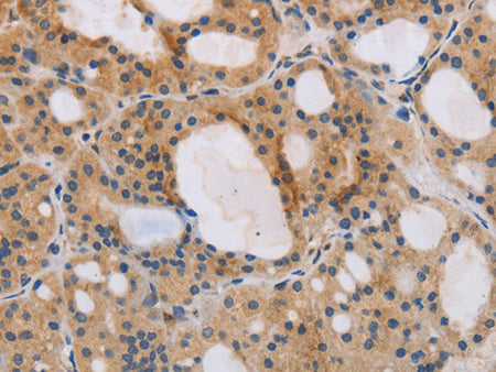 ITPR1 Polyclonal Antibody Store at -20°C