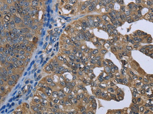 GPAM Polyclonal Antibody Store at -20°C