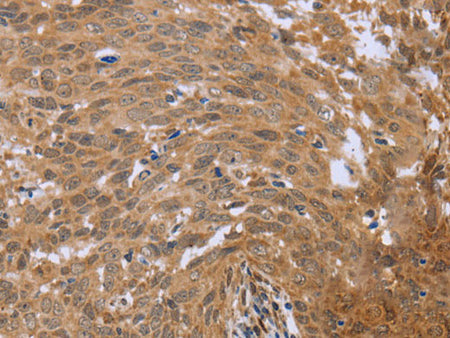 FHL2 Polyclonal Antibody Store at -20°C