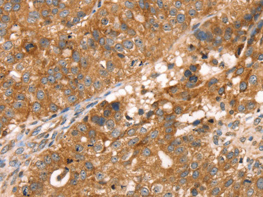 PDLIM4 Polyclonal Antibody Store at -20°C