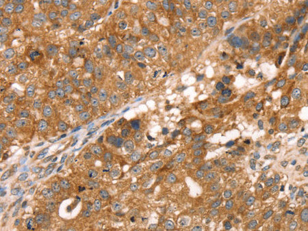 PDLIM4 Polyclonal Antibody Store at -20°C
