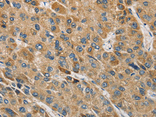 MIP Polyclonal Antibody Store at -20°C