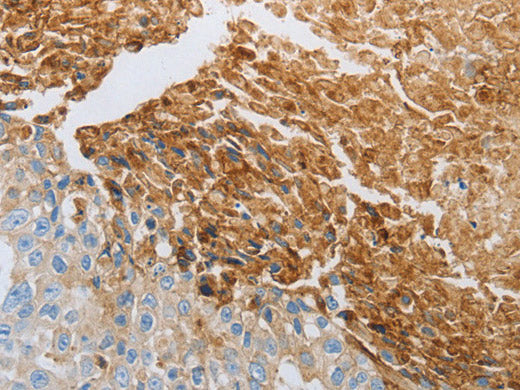 RTN4 Polyclonal Antibody Store at -20°C