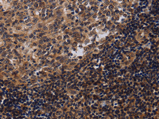 NTMT1 Polyclonal Antibody Store at -20°C