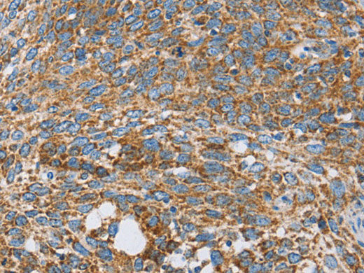 CENPO Polyclonal Antibody