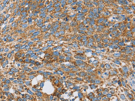 CENPO Polyclonal Antibody