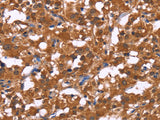 HLTF Polyclonal Antibody Store at -20°C